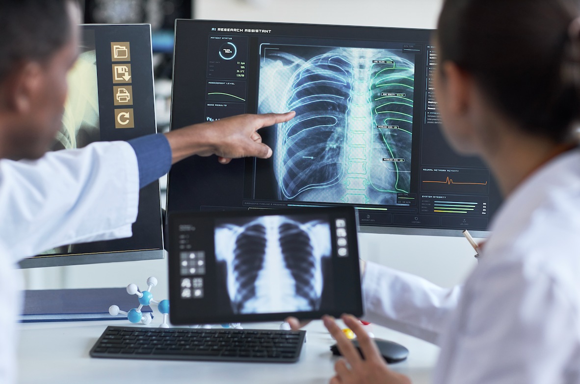 Tomografía pulmones