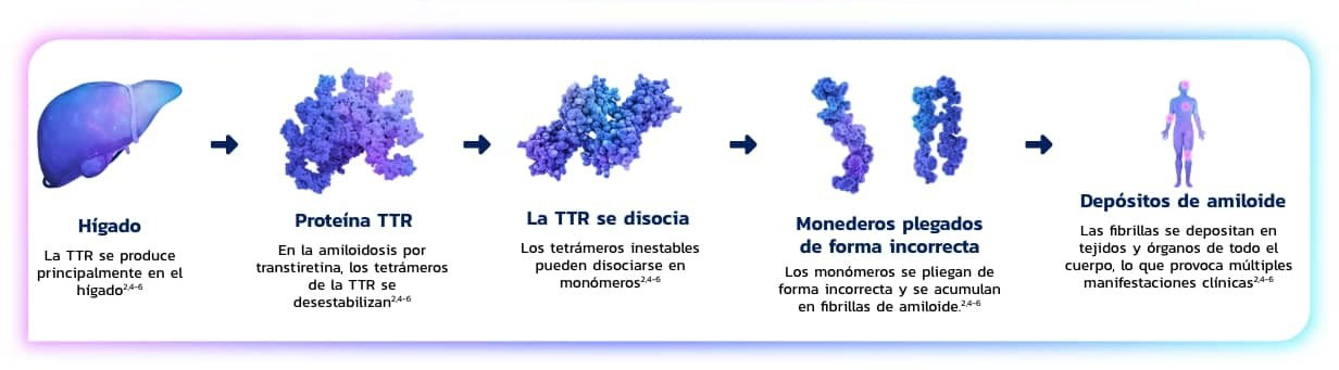 Diagrama que muestra la progresión de TTR producido en el hígado a tetrámeros inestables, monómeros plegados incorrectamente y depósitos de amiloides en los órganos.