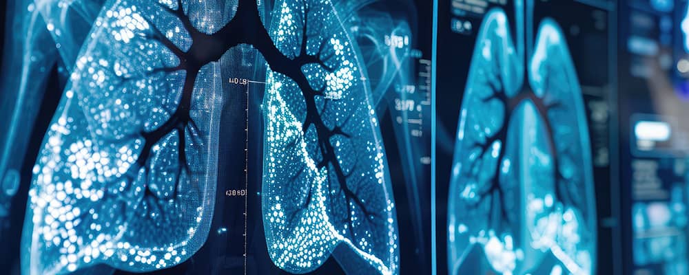 El Cribado del Cáncer de Pulmón (CP)