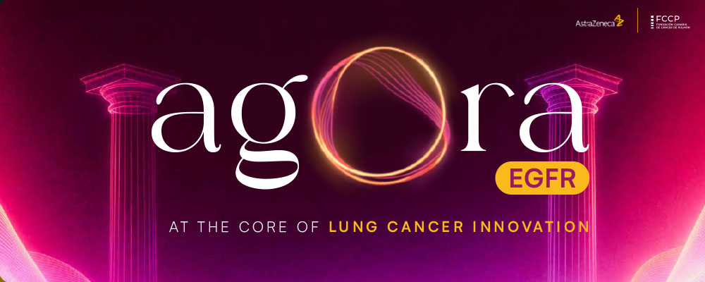 Banner promocional - Innovación en el manejo del cáncer de mama luminal