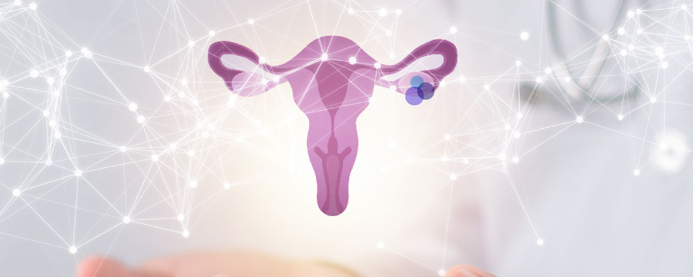 Imagen del sistema reproductivo femenino