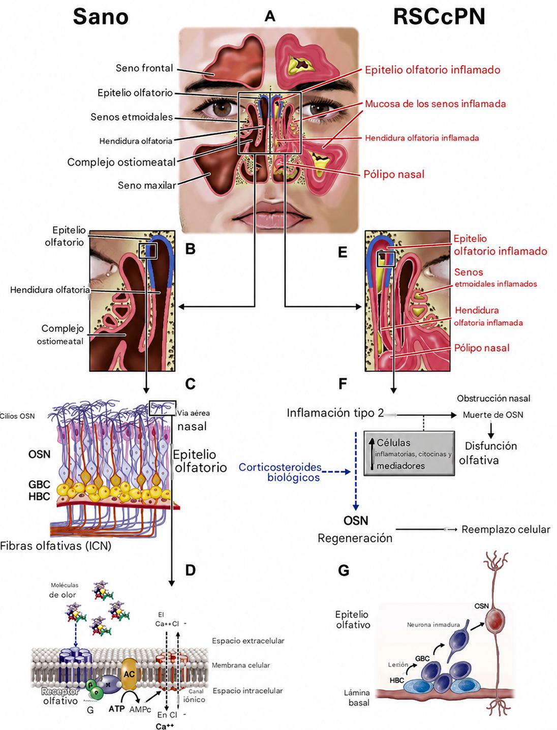 nasal imflamado