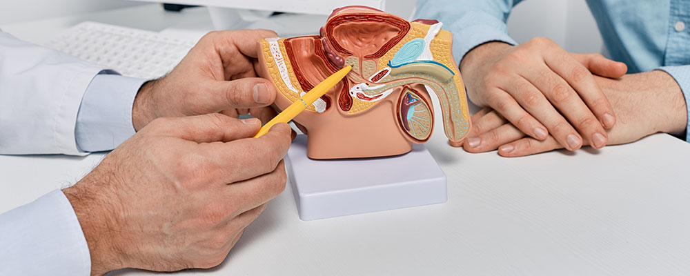 Anatomía de la próstata con un modelo
