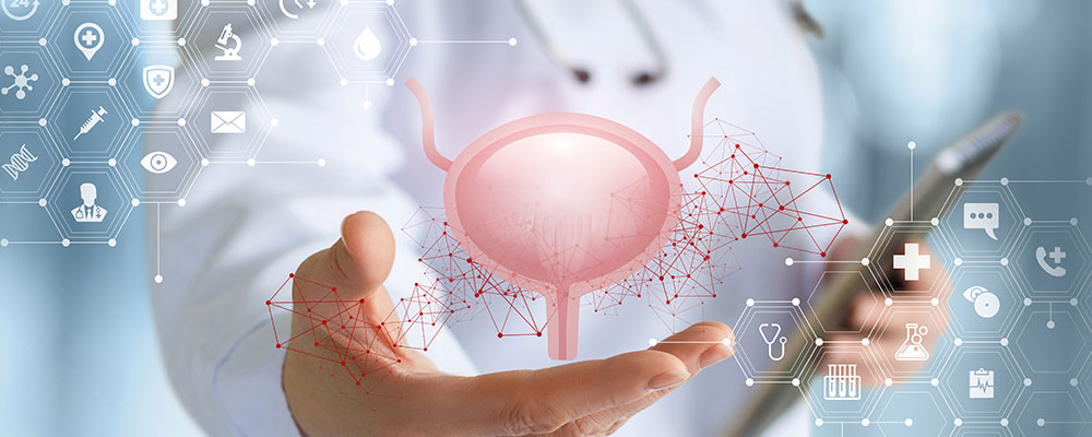 Ilustración médica de la vejiga para el cáncer músculo invasivo