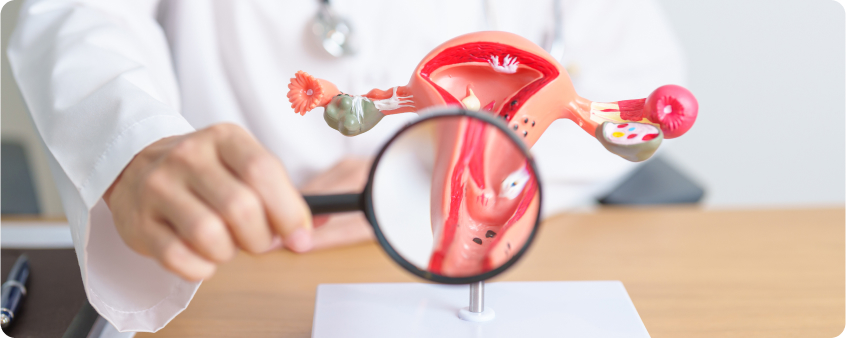 Pruebas de Cáncer de Endometrio Banner